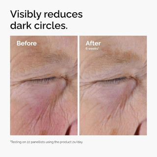 Ordinary Serum mắt làm giảm quầng thâm và chống lão hóa