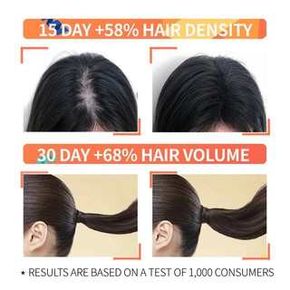 Ordinary Serum dưỡng tóc và tinh chất chăm sóc tóc