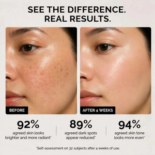 Ordinary Axit Ascorbic Serum Vitamin C trị đốm đen làm trắng da mặt dưỡng ẩm chăm sóc da mặt