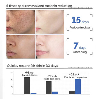 Ordinary Axit Ascorbic Serum Vitamin C trị đốm đen làm trắng da mặt dưỡng ẩm chăm sóc da mặt