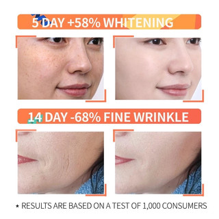 Ordinary Axit Ascorbic Serum Vitamin C trị đốm đen làm trắng da mặt dưỡng ẩm chăm sóc da mặt