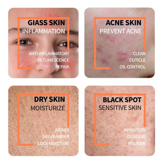 Ordinary Serum Axit Lactic tẩy tế bào chết da mặt và làm sáng da mặt chăm sóc da mặt