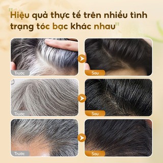Dr.ville Dầu Gội Hà Thủ ô Dầu Gội đen Tóc Thảo Dược đầu Dầu Gội Phủ Bạc Dầu Gội Cỏ Cây Hoa Lá Dầu Gội Nhuộm Tóc Bubble 300ML