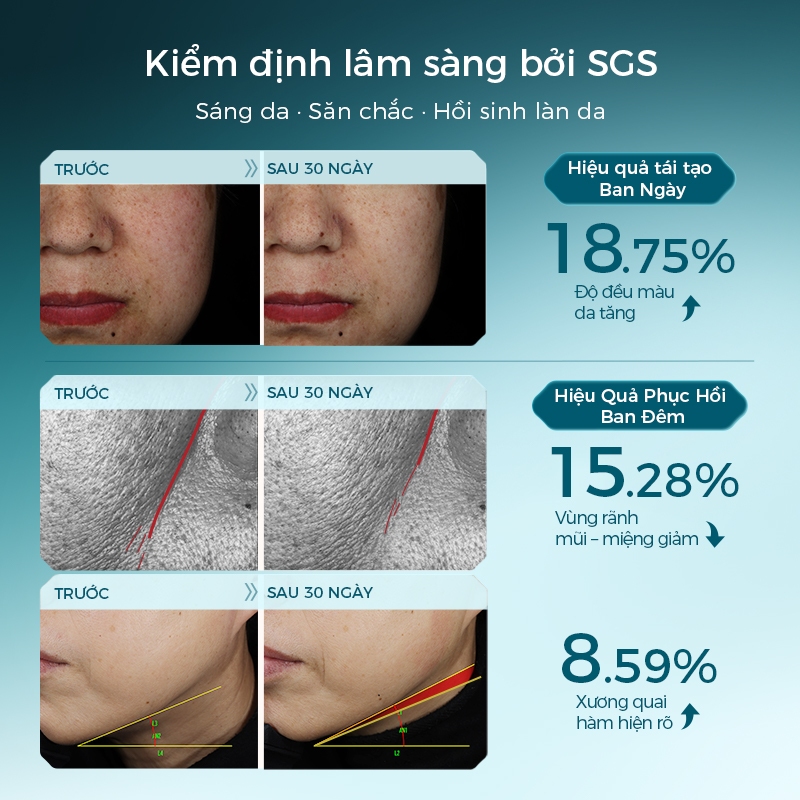 Florasis ( Hoa Tây Tử) Bộ Đôi Tinh Chất Serum Làm Sáng Da Chiết Xuất Hoa Sen 1.3ml*30