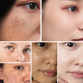Serum Ordinary Alpha Arbutin 2% + HA Tinh Chất Dưỡng Trắng Chăm Sóc Da 30ml