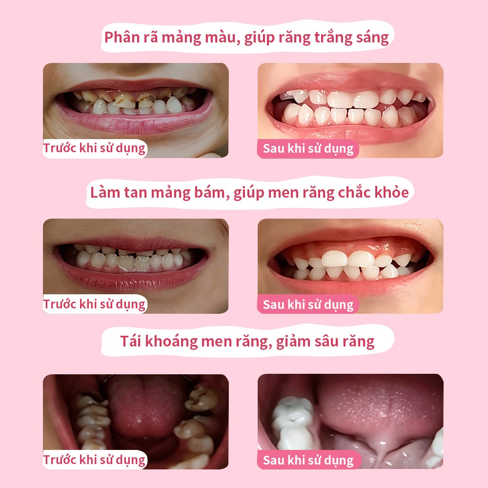 Bộ Kem Đánh Răng B.Duck Cho Bé Từ 5-12 Tuổi (Hương Dâu)