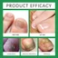 Laniska Roll-On Nail Care Serum 10ml - Dầu dưỡng móng tay bóng nhanh 3 ngày cho móng tay & lớp biểu bì khô - Serum dưỡng ẩm nhẹ để phục hồi móng tay khỏe mạnh sáng bóng mịn màng