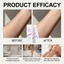Xịt tẩy lông toàn thân không đau nhẹ nhàng Cloudsense 140ml Bọt làm rụng lông Mousse Dễ dàng rửa sạch Loại bỏ cánh tay chân Lông nách với thìa miễn phí