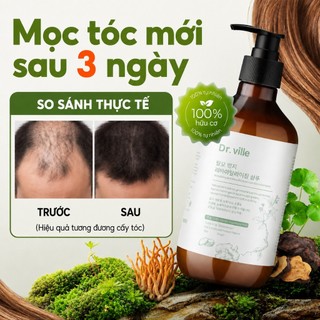Dr.ville Tóc Dầu Gội Mọc Tóc Và Chống Ngăn Rụng Dầu Gội Gừng Thảo Mộc Kích Mọc Tóc Dầu Gội Giảm Rụng Tóc 500ml