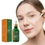 Vitamin C Serum Cho Mặt - Dầu Làm Sáng Da Mặt Cho Vết Thâm & Tuổi Tác - Dành Cho Da Khô & Nhạy Cảm Với Vitamin E Cho Mềm Phát Sáng Mịn - Bác Sĩ Da liễu Đã Kiểm Tra, 1 Fl Oz