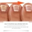 South Moon Nail Renew Patches 72 Miếng dán chăm sóc móng tay đa năng 8 giờ Sử dụng qua đêm Làm sáng da Móng tay dày đổi màu Vệ sinh Dễ dàng sử dụng Miếng dán điều trị làm mới móng tay
