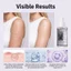Mụn cóc lên men gạo đen Serum tái tạo AHA BHA Plant Squalane Tinh chất tẩy tế bào chết nhẹ nhàng Dưỡng ẩm Nuôi dưỡng Cải thiện nếp nhăn Không đều tông màu da Làm sáng da Serum chăm sóc da
