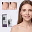 Mụn cóc lên men gạo đen Serum tái tạo AHA BHA Plant Squalane Tinh chất tẩy tế bào chết nhẹ nhàng Dưỡng ẩm Nuôi dưỡng Cải thiện nếp nhăn Không đều tông màu da Làm sáng da Serum chăm sóc da