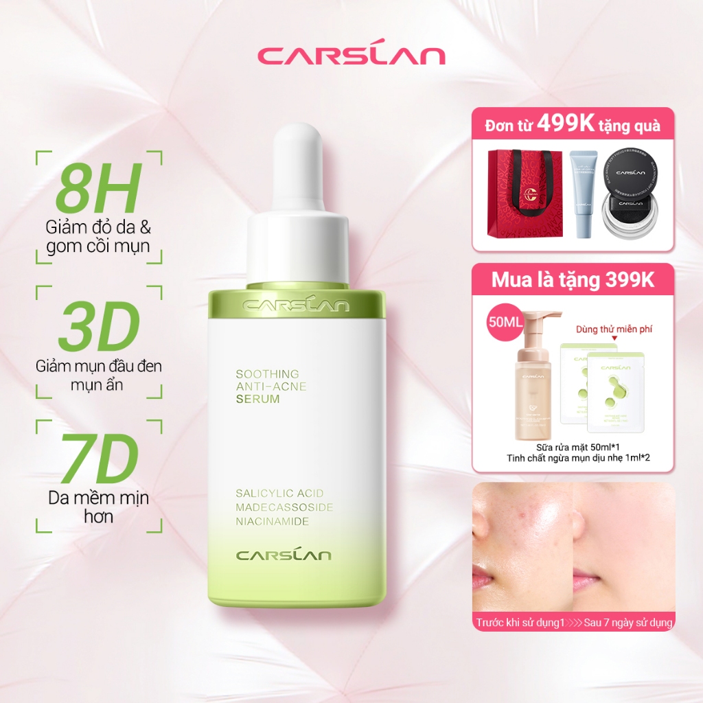 Serum Hỗ trợ giảm mụn Carslan Soothing 30ml