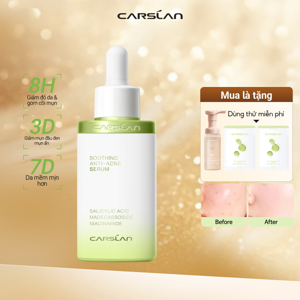 Serum Hỗ trợ giảm mụn Carslan Soothing 30ml