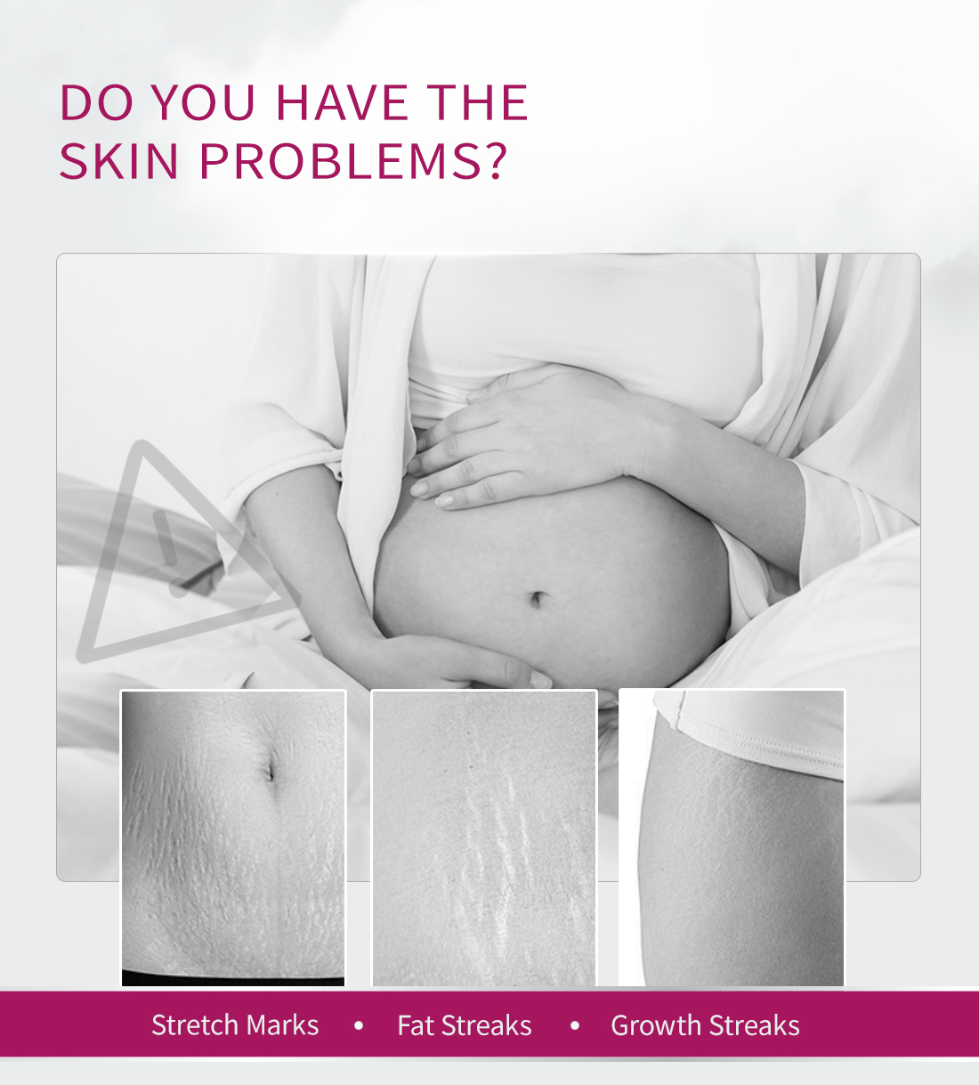 Mô tả RtopR Xoài Xóa Sẹo Mang Thai Kem Rạn Da Kem Làm Săn Chắc Cơ Thể 40g RtopR Mango Remove Pregnancy Stretch Marks Maternity Cream - 2