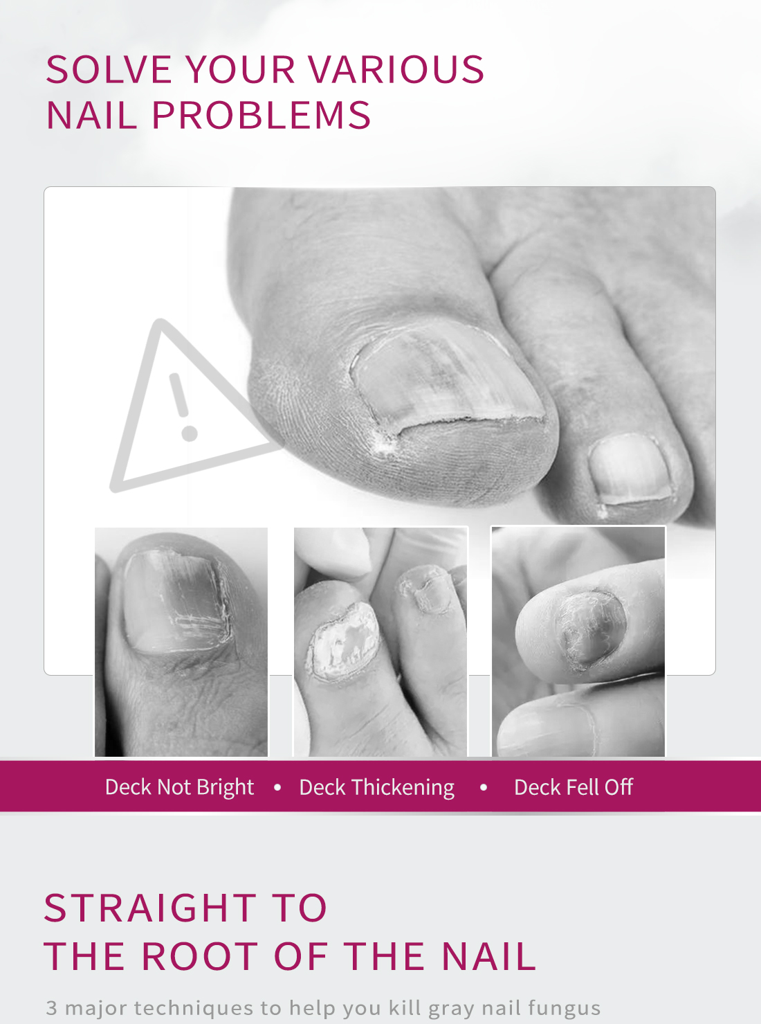Mô tả Tinh chất gừng RTOPR kháng khuẩn hỗ trợ giảm bệnh nấm móng chân 10ml - 2