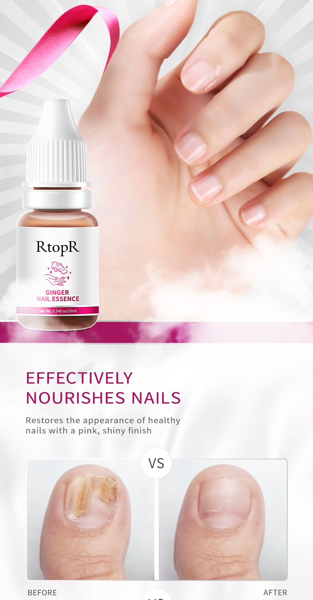 Mô tả Tinh chất gừng RTOPR kháng khuẩn hỗ trợ giảm bệnh nấm móng chân 10ml - 7