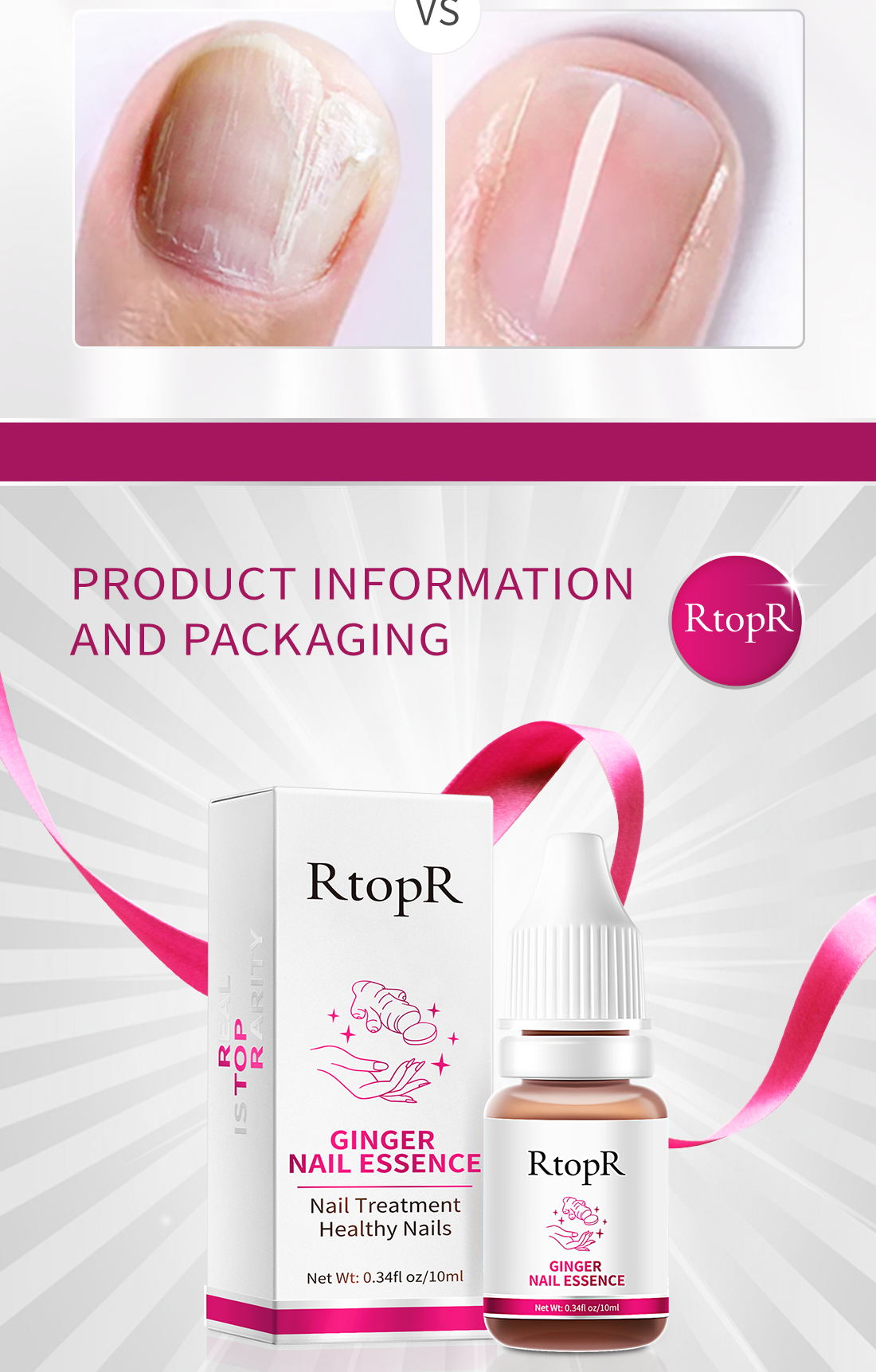 Mô tả Tinh chất gừng RTOPR kháng khuẩn hỗ trợ giảm bệnh nấm móng chân 10ml - 8