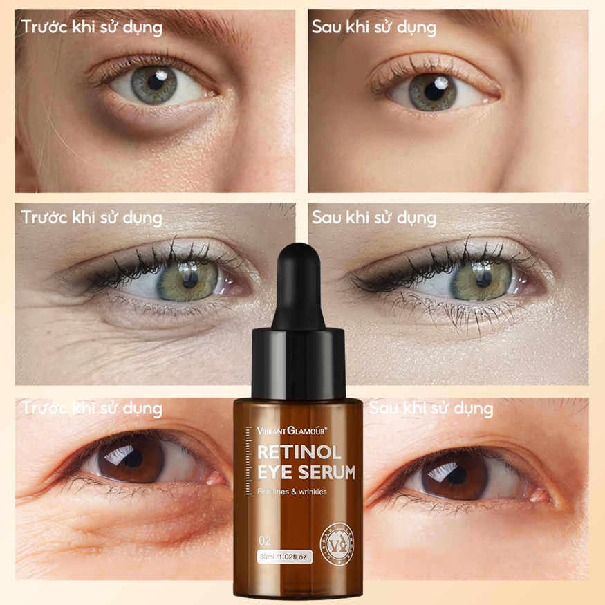 Công dụng Tinh chất dưỡng mắt Retinol VIBRANT GLAMOUR