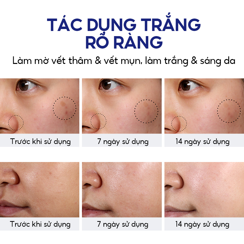 Mô tả Serum 5% Niacinamide VIBRANT GLAMOUR 5X Ceramide Làm trắng và Giảm vết thâm tàn nhang & Giảm mụn trứng cá và mẩn đỏ 30ml - 5