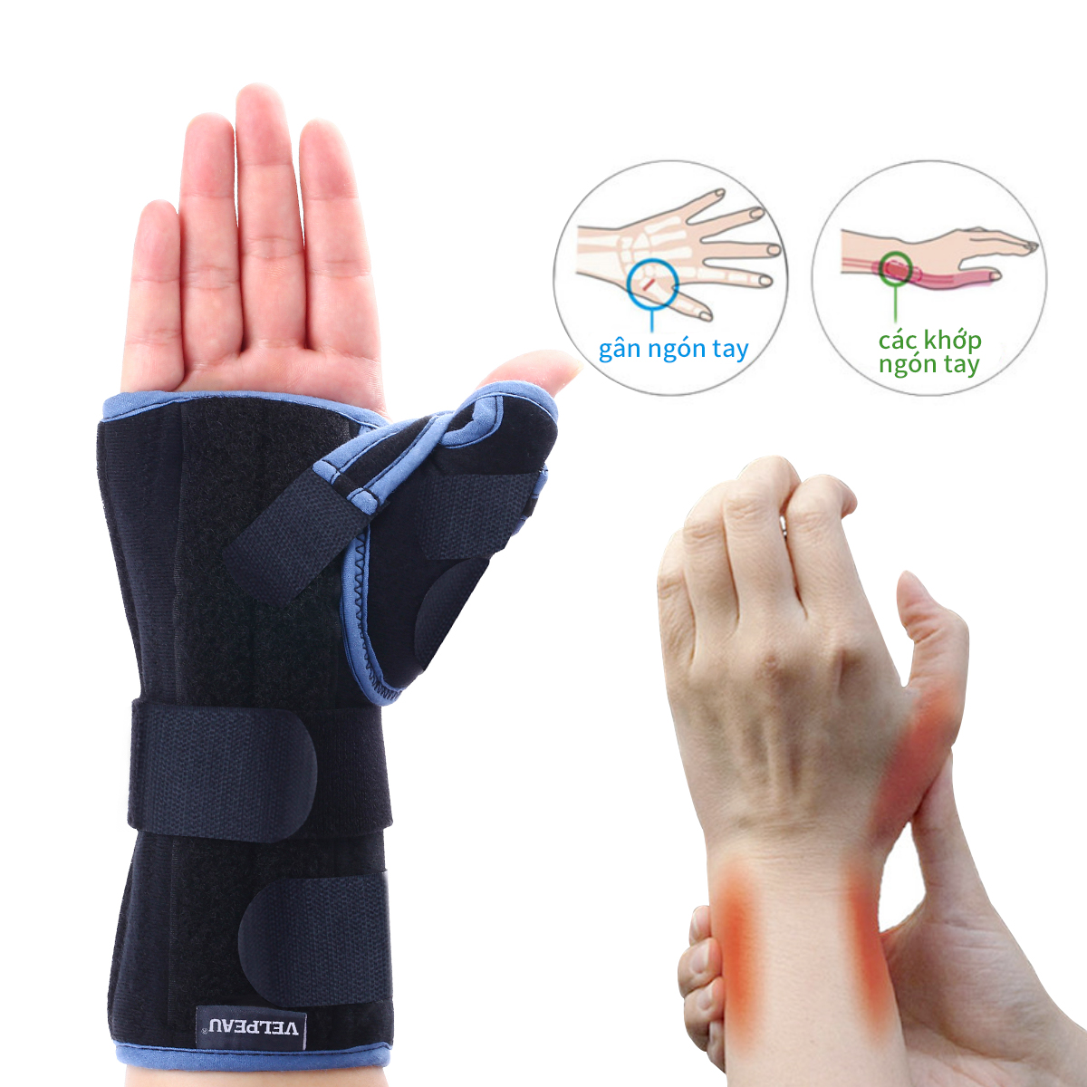 Mô tả Nẹp đeo cổ tay Velpeau với găng tay bảo vệ ngón cái cho bệnh hội chứng De Quervain, đau cổ tay, ổn định cho viêm gân, viêm khớp, trật khớp & gãy xương hỗ trợ cánh tay. - 6