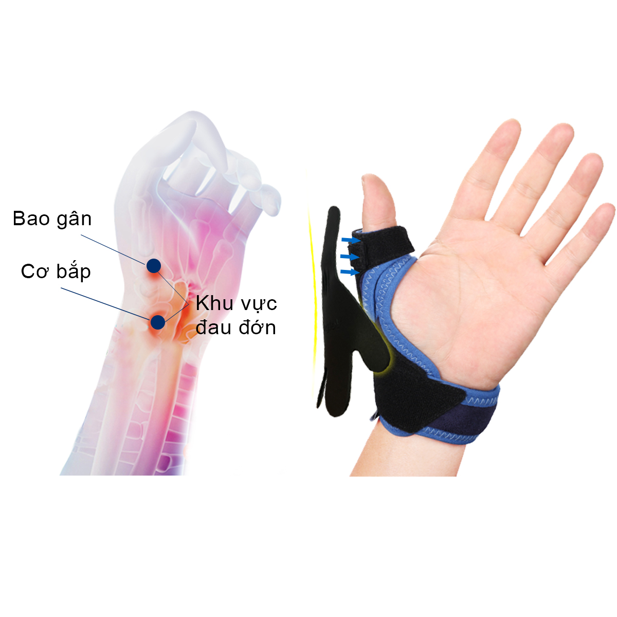 Mô tả Dụng cụ hỗ trợ ngón cái VELPEAU-CMC đầu ngón tay Spica, được sử dụng để giảm đau, viêm khớp, viêm cơ, bong gân, trật khớp, cổ tay và băng đeo cố định ngón cái, dây đeo cổ tay - 1