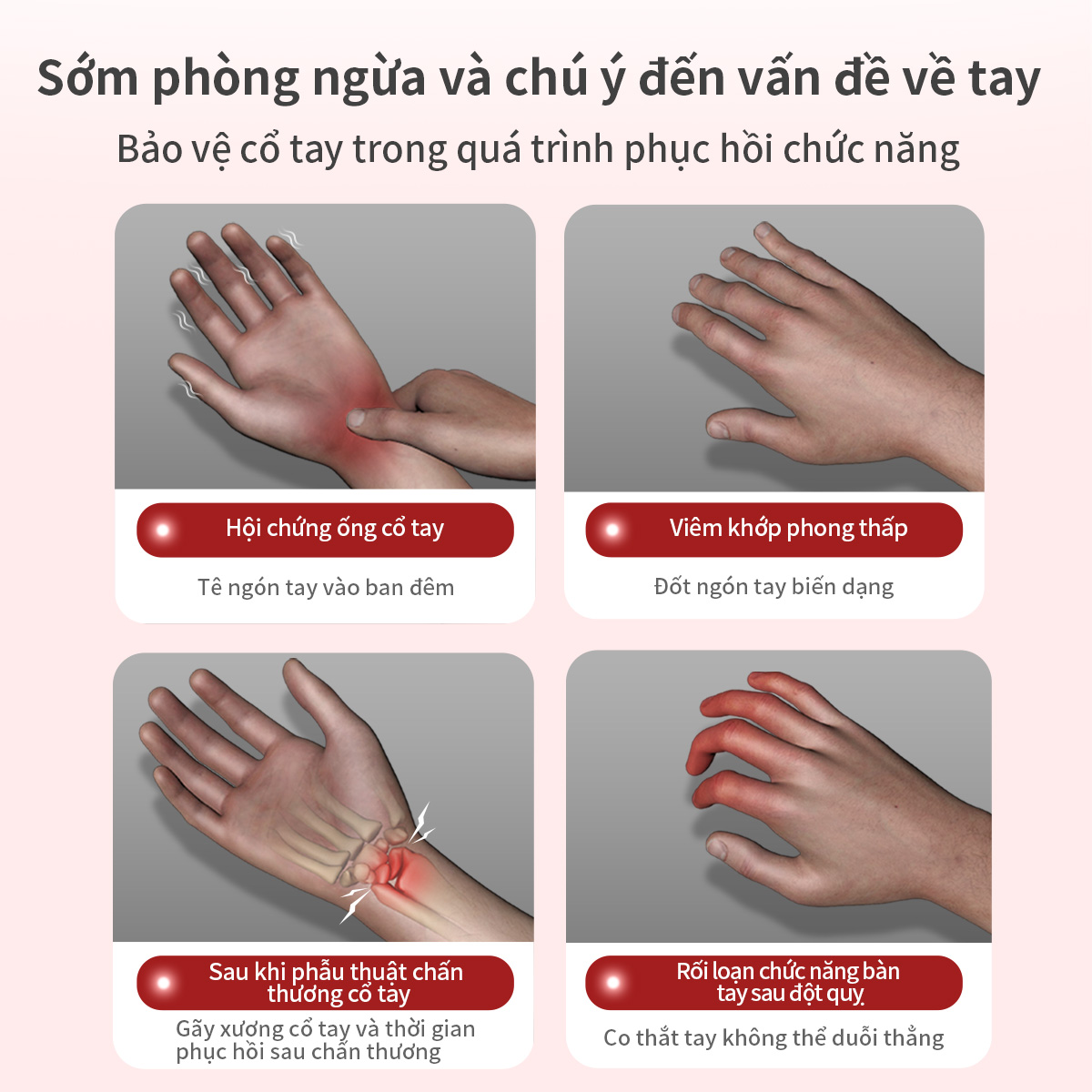 Mô tả Nẹp tay VELPEAU nghỉ ngơi đột quỵ Cố định ban đêm Nẹp cổ tay với hỗ trợ ngón tay Ổn định ngón tay cái Bọc cơ tay Phục hồi chức năng Viêm khớp Viêm gân Đau ống cổ tay - 3