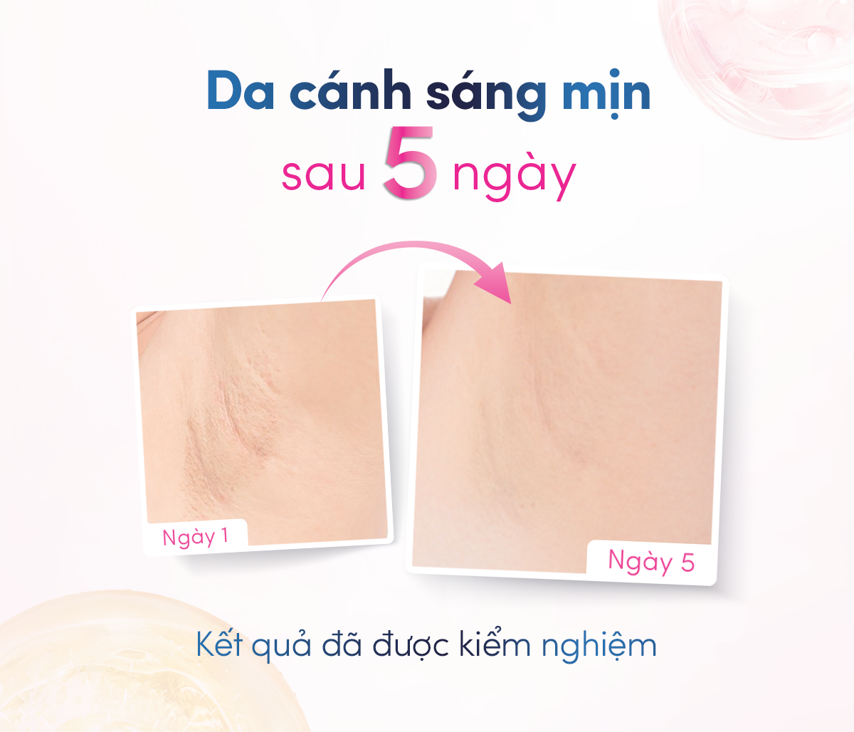 Mô tả [CHÍNH HÃNG] Dove Serum dưỡng sáng khử mùi Dove dành cho nữ với 3% Niacinamide giúp da sáng mịn đều màu 40ml tốt như lăn - 4