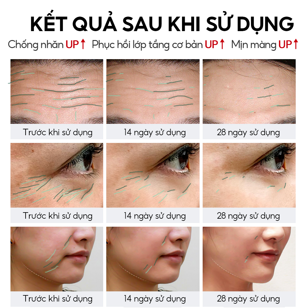 Hướng dẫn sử dụng Serum Retinol