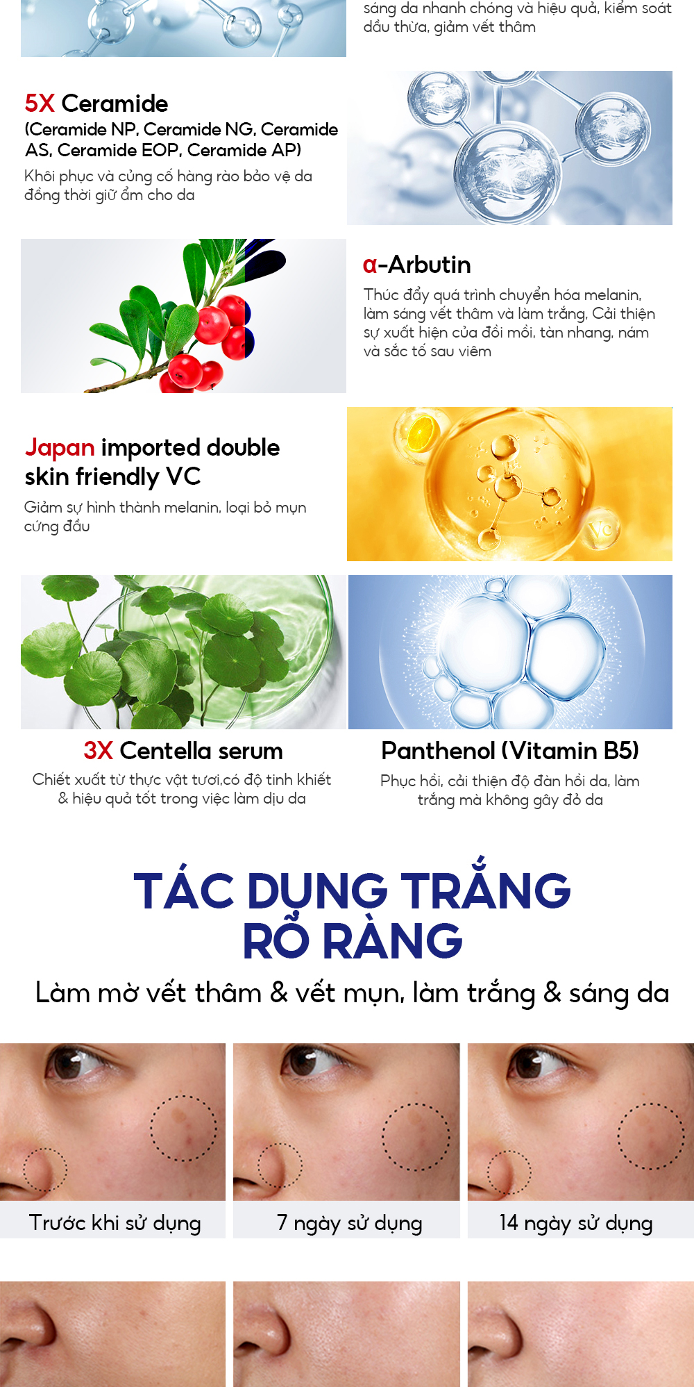 Mô tả ROYAL DSM Niacinamide & 5X Ceramide 2PCS VIBRANT GLAMOUR 5% + 8% Niacinamide + 3X Centella，Làm Trắng Nhanh & Mờ Đốm Đen, Tàn Nhang & Giảm Sự Tích Tụ Melanin $ Nuôi Dưỡng Sâu & Giảm Đỏ Da, 30ml + 30g - 7