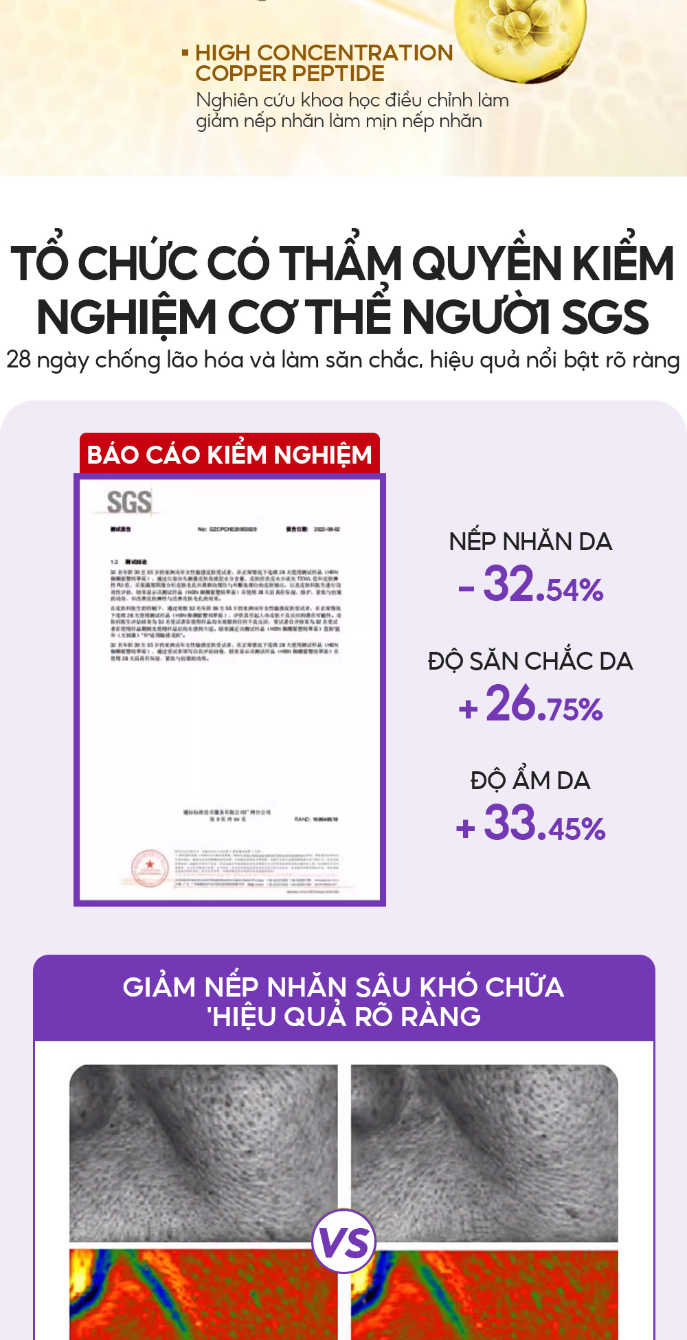 Mô tả Serum Retinol Pro-xylane 3X Chống Lão Hóa 15pcs*2ml VIBRANT GLAMOUR Làm Săn Chắc & Giảm Nếp Nhăn & Làm Mịn Da & Tăng Cường Rạng Rỡ & Dưỡng Ẩm Sâu - 2