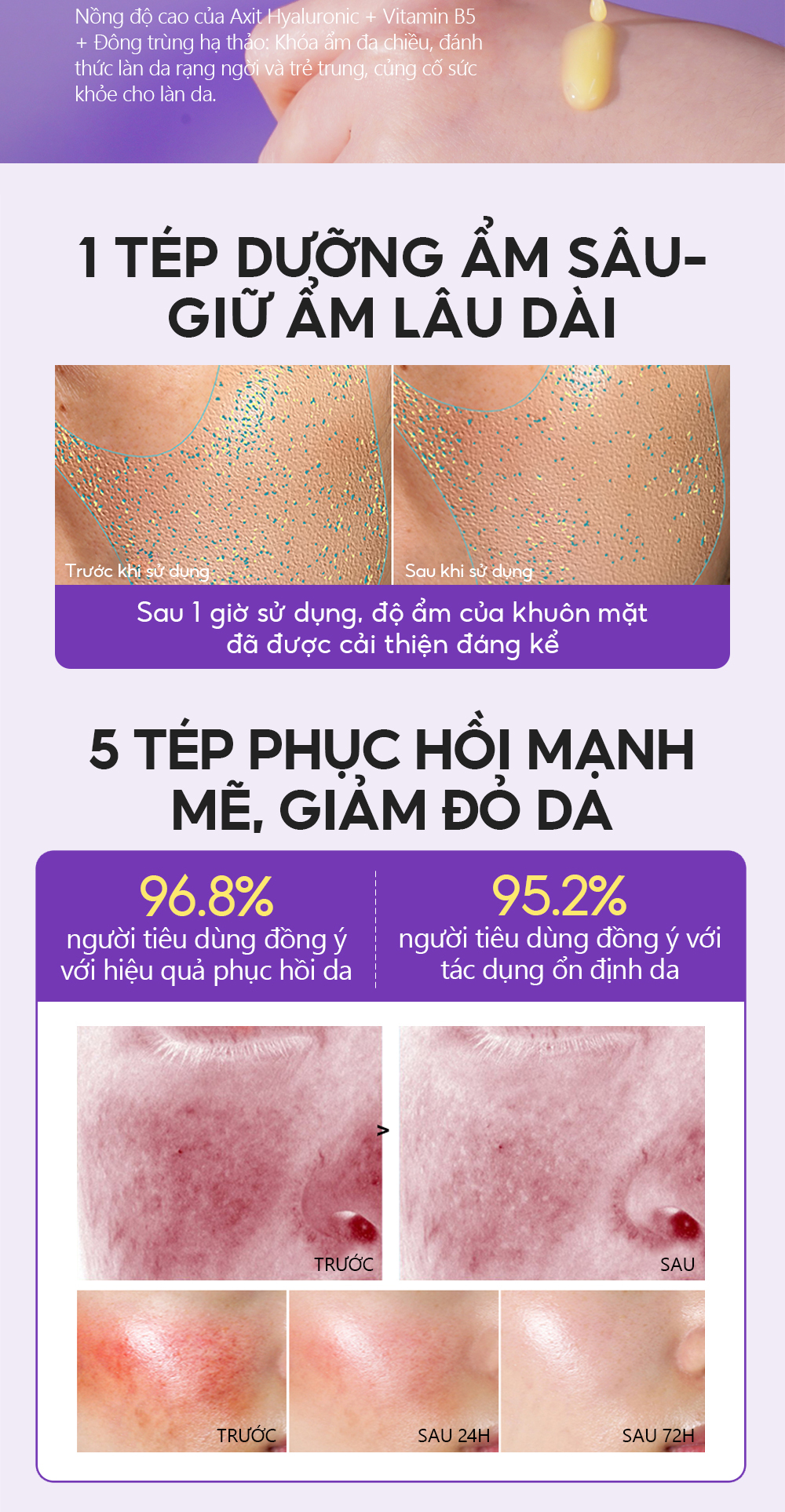 Mô tả Serum Retinol Pro-xylane 3X Chống Lão Hóa 15pcs*2ml VIBRANT GLAMOUR Làm Săn Chắc & Giảm Nếp Nhăn & Làm Mịn Da & Tăng Cường Rạng Rỡ & Dưỡng Ẩm Sâu - 8
