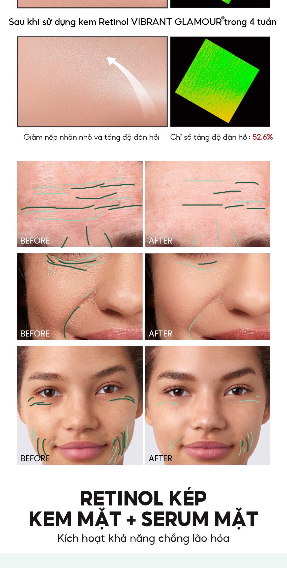 Mô tả Niacinamide + Retinol Bộ Sáng/Đêm 4PCS VIBRANT GLAMOUR Bộ Chăm Sóc Da Đơn Giản Ban Ngày/Ban Đêm Làm Trắng Da & Giảm Thâm Nám & Chống Lão Hóa & Bổ Sung Collagen & Dưỡng Ẩm Lâu Dài - 3