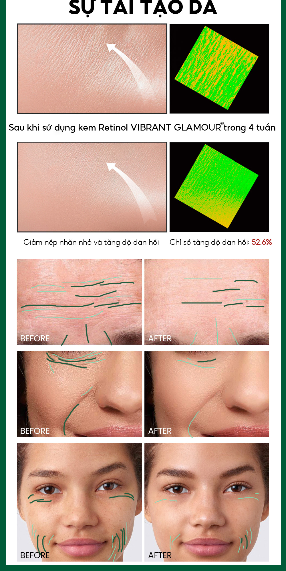 Thành phần Niacinamide Retinol VIBRANT GLAMOUR