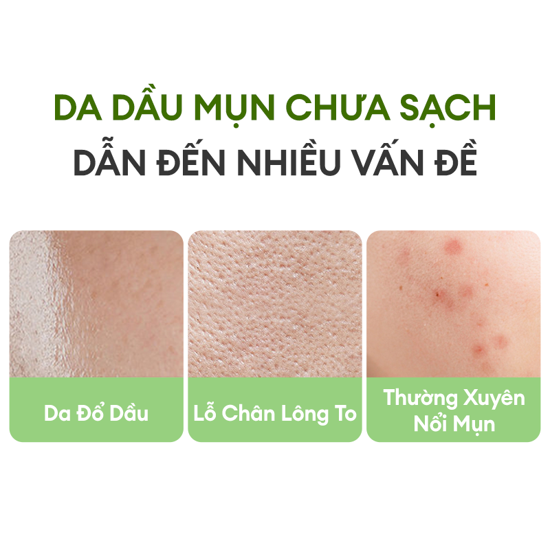 Mô tả Mặt Nạ Bùn Trà Xanh COLORKEY LUMINOUS Làm Sạch Da Không Gây Khô Da Khi Dùng 60g/hũ - 2