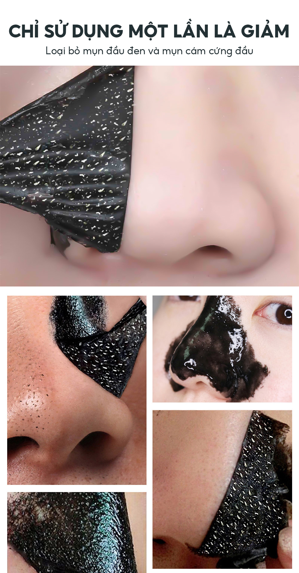 Lợi ích của than tre trong mặt nạ lột mụn