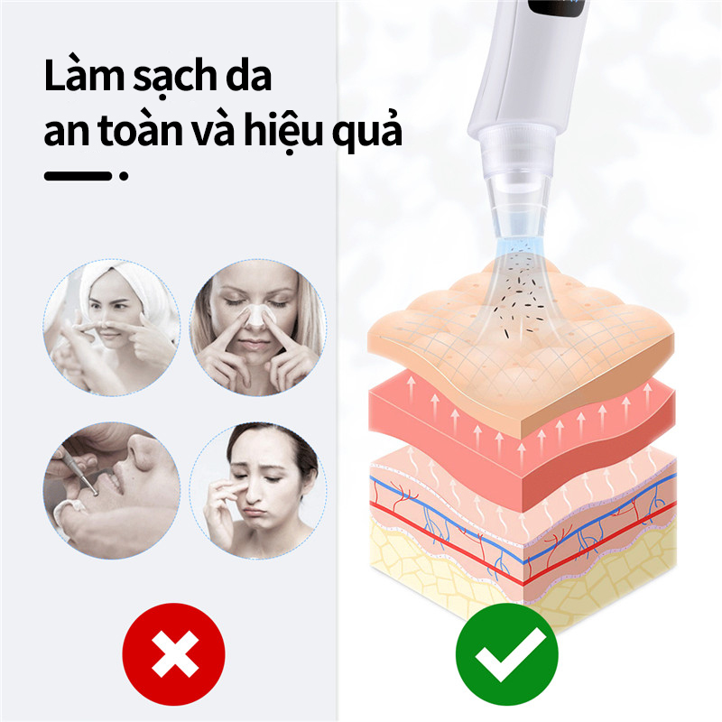 Mô tả CkeyiN Máy hút mụn đầu đen làm sạch lỗ chân lông kèm 5 đầu hút chuyên dụng máy hút mụn cầm tay MR596 - 2