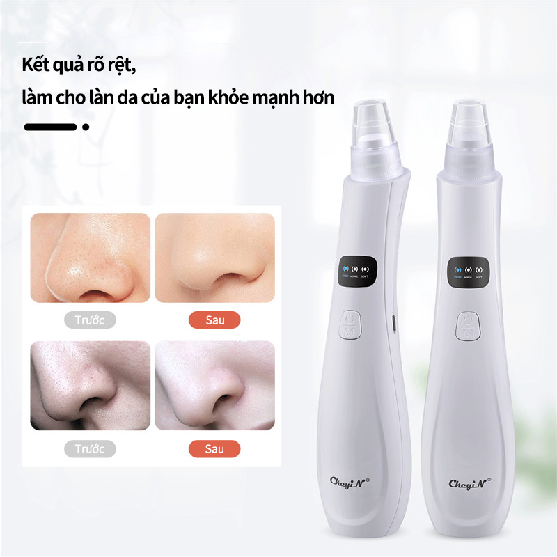 Mô tả CkeyiN Máy hút mụn đầu đen làm sạch lỗ chân lông kèm 5 đầu hút chuyên dụng máy hút mụn cầm tay MR596 - 3