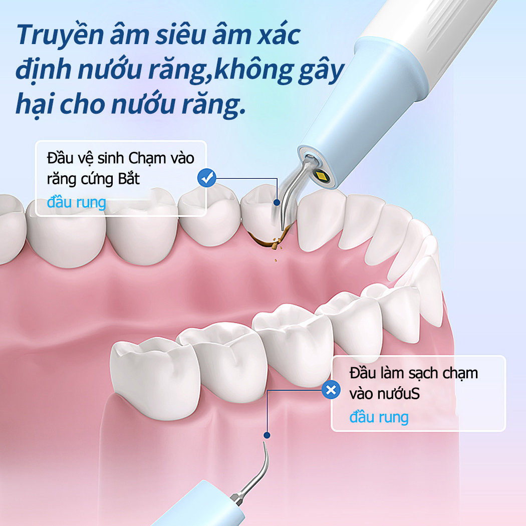 Mô tả CkeyiN Máy lấy cao răng tại nhà  ,máy cạo vôi răng cá nhân chăn sóc răng miệng，DE006 - 3