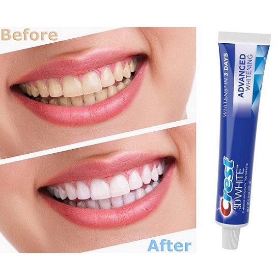 Kem đánh răng Crest 3D Advance White chính hãng Mỹ - Giúp răng trắng sáng tự tin giao tiếp
