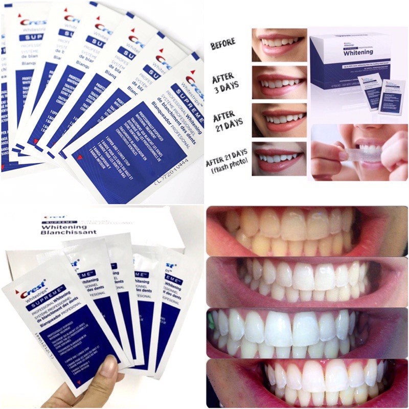 Full Liệu trình 20 ngày (20 gói) miếng dán trắng răng Crest Professional Effects