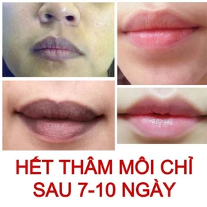 Tẩy Thâm Môi Collagen Thiên Di Dưỡng Môi Hồng Tự Nhiên Giúp Môi Luôn Hồng Hào Lọ 8gr Date 2024