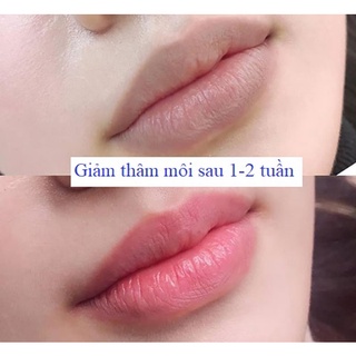Son Dưỡng Môi Collagen Thiên Di Khử Thâm Môi, Dưỡng Hồng Môi Và Ti Giúp Môi Mềm Mịn An Toàn CHo Mẹ Mầu Và Sau Sinh