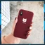 Ốp lưng iphone Chó Shiba cực xinh cute ip 6 6plus 6s 6s plus 7 7plus 8 8plus x xs xs max 11 11 pro 11 promax (a141)