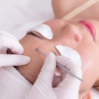 Bộ 4 cây lấy mụn 8 đầu tiện lợi