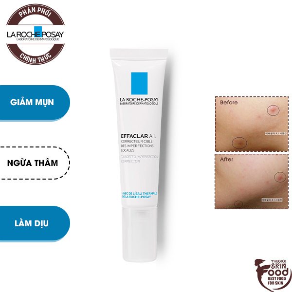 Kem Chấm Mụn Chuyên Biệt La Roche Posay Effaclar A.I. Targeted Breakout Corrector 15ml | Shopee Việt Nam