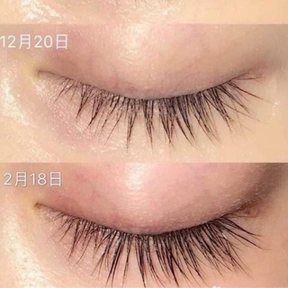 [Chính hãng] Dưỡng mi 4 Long Lashes Ba Lan