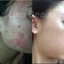Serum giảm mụn mờ thâm - YU SKIN - Công dụng 3 trong 1 hiệu quả sau 7 ngày