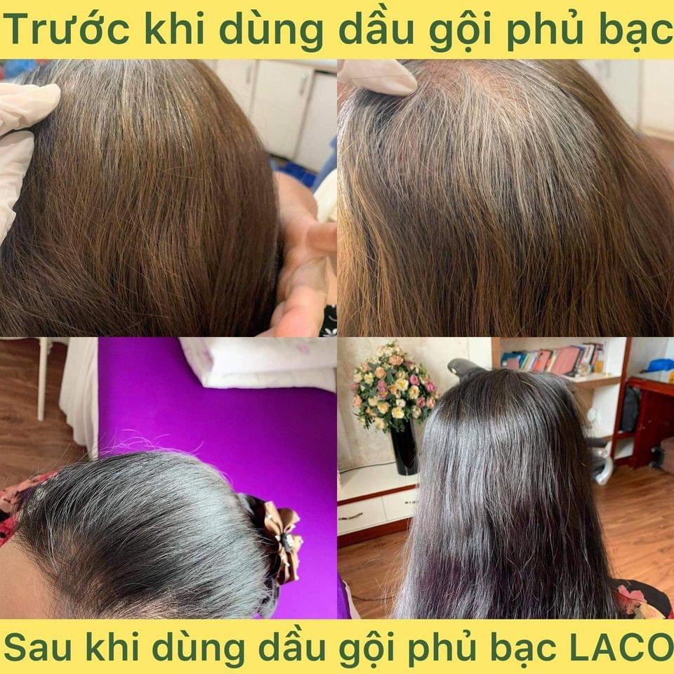 Tóc đen làm nổi bật vẻ đẹp khỏe mạnh, tự tin của bạn. Với dầu gội phủ bạc Laco Black Hair, tóc đen của bạn sẽ được chăm sóc một cách tinh tế để giữ được màu sắc bền lâu.